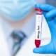 An image of a doctor holding up a blood sample tube labeled allergy test